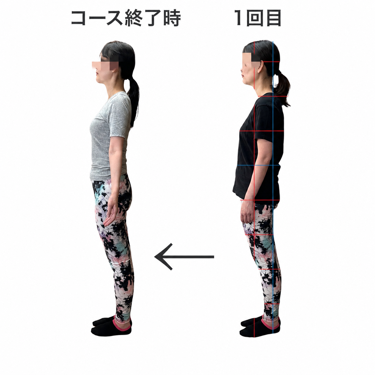 姿勢のビフォーアフター CASE 04 側面