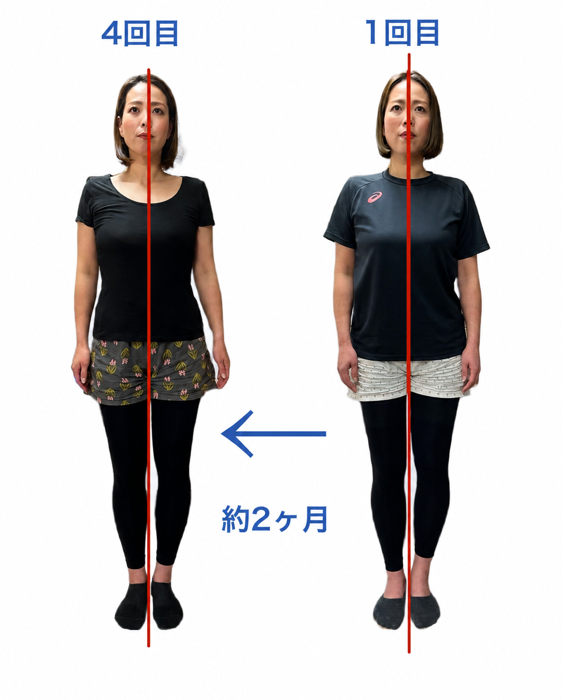 姿勢のビフォーアフター CASE 02 正面