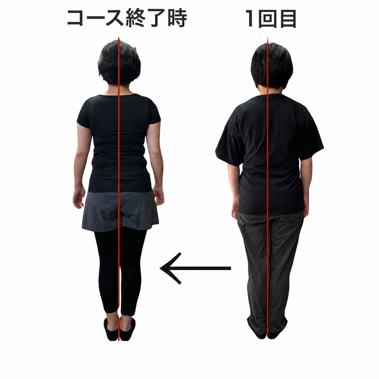 姿勢のビフォーアフター CASE 05 背面