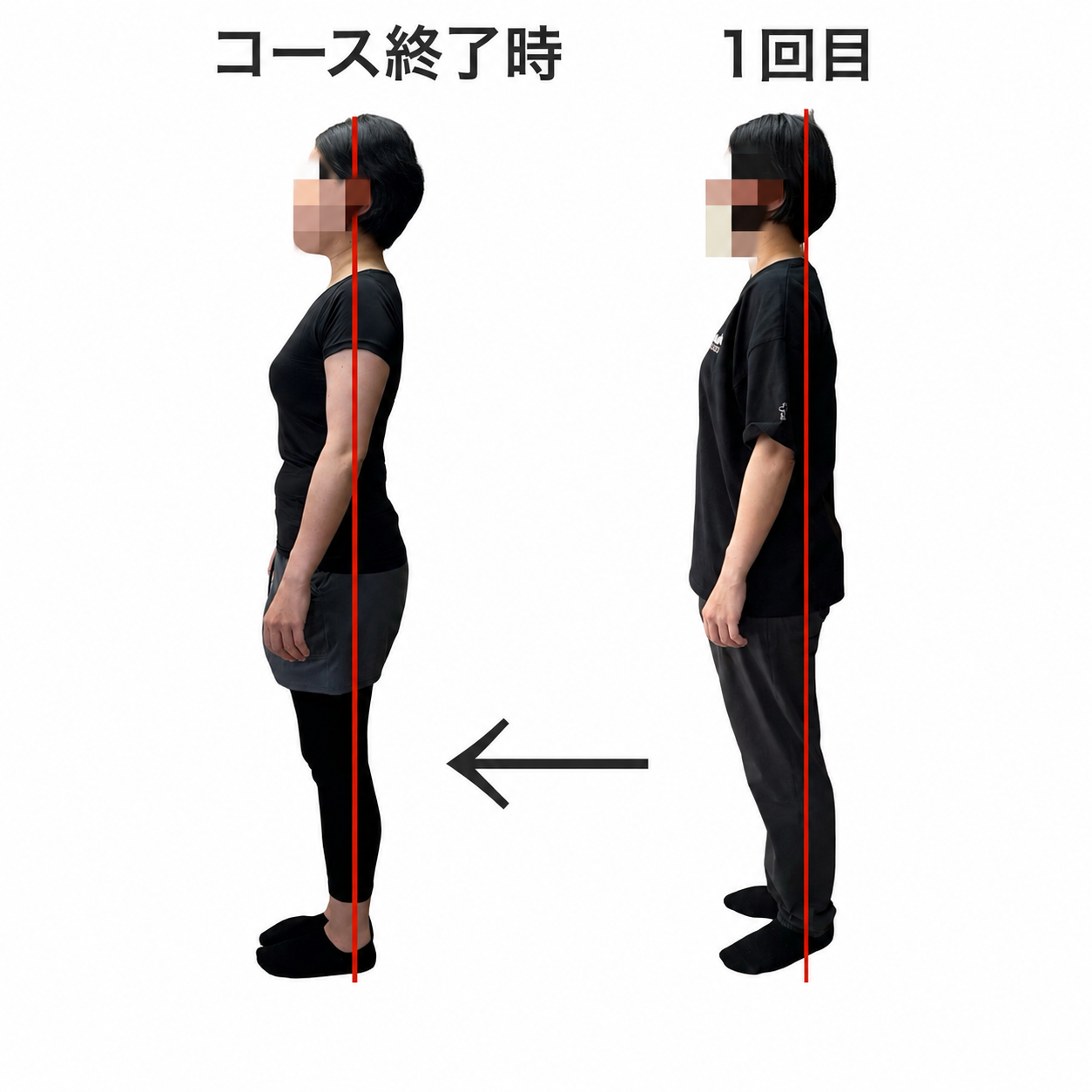 姿勢のビフォーアフター CASE 05 側面